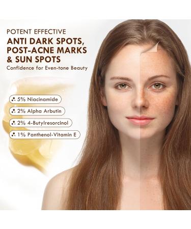 Dark Spot Remover for Face and Body Age Spot Remover for Face Dark Spot Corrector Freckle Remover Sunspots and Melasma with 2% Alpha Arbutin 5% Niacinamide 50 ml - Buy Online on GoSupps.com