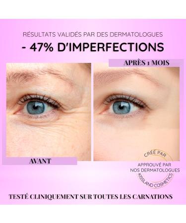 Retinol Anti-blemish Face Serum with Caffeine and Elastin 60ml - Retinol Anti-Blemish Face Serum Reduces Acne Marks and Dark Spots - Anti-Blemish Face Serum - Buy Online on GoSupps.com