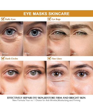 Vitamin C Under Eye Patches - 10 Pair Vitamin C Eye Masks Reduce Dark Circles and Puffy Eyes Eye Patches For Dark Circles Hydrating Under Eye Mask Eye Pads For Bags & Wrinkles Eye Masks Skincare - Buy Online on GoSupps.com