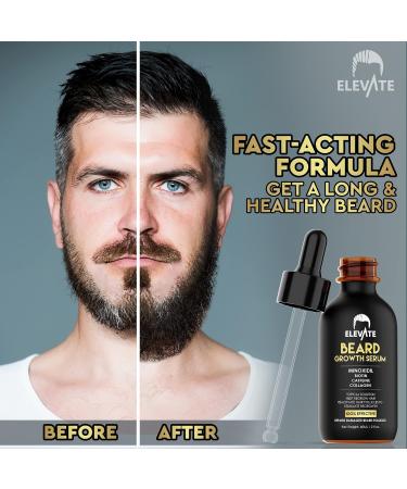 Elevate Beard Growth Oil 5% Minoxidil Serum with Biotin & Caffeine - 1 Fl Oz (Pack of 1) | Natural Facial Hair Treatment for Thicker Fuller Beard Growth - Buy Online on GoSupps.com