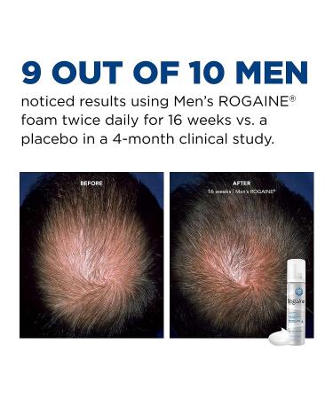 Mens Rogaine 5% Minoxidil Foam - Hair Loss Treatment - 1-Month Supply - Buy Online on GoSupps.com