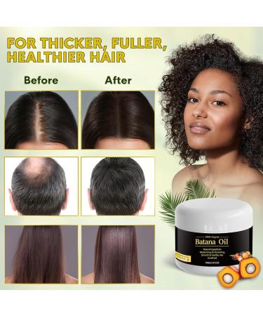 Buy Batana Hair Growth Oil - 100% Raw Organic Oil from Honduras for Men & Women | Anti Hair Loss & Split Ends Treatment - 3.4 FL oz - Buy Online on GoSupps.com