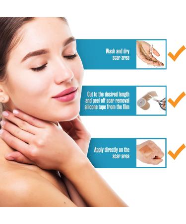 Houseables Silicone Scar Sheets Gel Tape 1.57 x 60 - Tan, Flexible Medical Grade for Surgery, Keloids, Burns - Sensitive Skin, Wound Protection - Healing Gel Patch - Buy Online on GoSupps.com