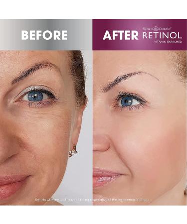 Retinol Anti-Aging Cleansing Towelettes - All-in-One Makeup Remover & Toner Wipes for Exfoliating, Hydrating & Refreshing Skin - Buy Online on GoSupps.com