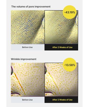 celimax S rum Raffermissant Vita A Retinol Shot La Vitamine A Pure (R tinol) Aux Peptides Minimisateur De Pores Rides Et Ridules Pour Une Peau Plus Ferme (30 Ml) - Buy Online on GoSupps.com