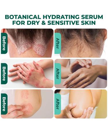 ABERA Alan Silver Serum Botanical Hydrating Serum for Dry & Sensitive Skin Nourishes & Moisturizes with Black Ginger Cedar Oil & Neem Lightweight Formula for All Skin Types 1 Box - Buy Online on GoSupps.com