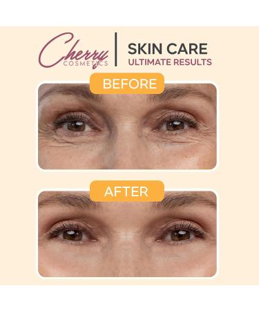 Skincare Set with Vitamin C Serum Retinol Serum and Hyaluronic Acid Serum. Face Serum Trio with Anti-Ageing / Anti-Wrinkles Instant Effect Against Pigment Spots Pimples and Age Spots - Buy Online on GoSupps.com