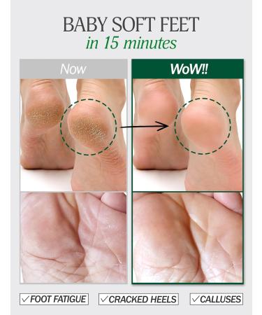 Moisturizing Foot Mask | 5 Pairs at Home Foot Spa Kit | Dead Skin Remover Foot Gloves | Pedicure & Foot Care Products for Women & Men - Buy Online on GoSupps.com