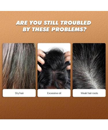  Holdes Moisturizing Shampoo | 150g Fortifying Care Shampoo with Massage Nozzle | Scalp Exfoliating Cream For all hair types women men and women on the go - Buy Online on GoSupps.com