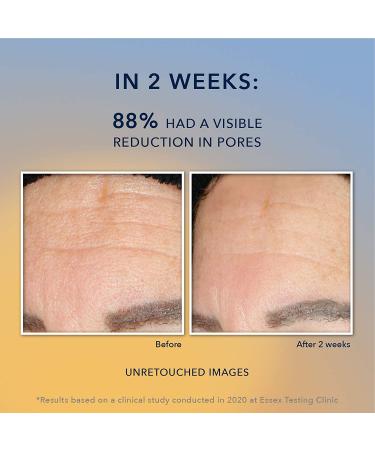 RoC Multi Correxion Revive & Glow Gel Cleanser with Vitamin C - 6 fl oz (177 ml) - Buy Online on GoSupps.com