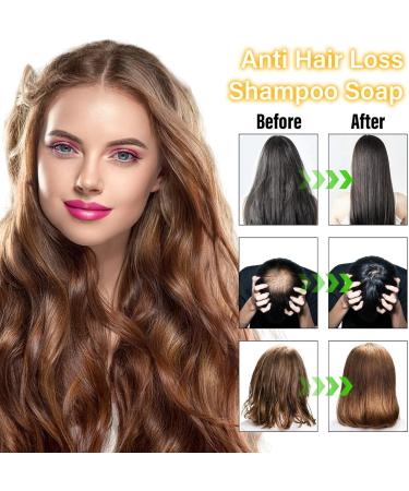 Batana Oil Shampoo Bar Batana Oil Solid Shampoo for Hair Growth 100% Natural Batana Oil Shampoo Anti Hair Loss Shampoo Soap for Repairs Damaged Hair Reduces Loss Promotes Regrowth Soothe Scalp - Buy Online on GoSupps.com