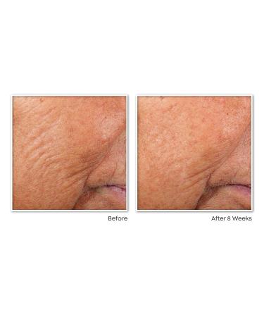 RoC Retinol Correxion Line Smoothing Night Serum Capsules Daily Anti-Aging Skin Care Treatment for Fine Lines Dark Spots Acne Scars 10 Count (Pack of 2) - Buy Online on GoSupps.com