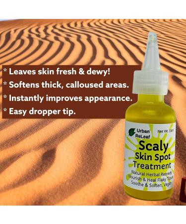 Urban ReLeaf Scaly Skin Spot Treatment - Natural Repair Oil for Flaky, Cracked, Dry Skin on Body & Face - Buy Online on GoSupps.com