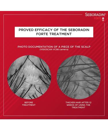 Seboradin Forte Hair Balm for Hair Loss & Thinning - 400 ml | Premium Conditioner with Vitamins & Natural Extracts for Thickening & Growth | Natur Technology Hair & Scalp Treatment - Pack of 1 - Buy Online on GoSupps.com