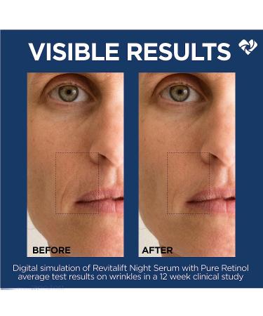 L'Oreal Paris Revitalift 0.3% Pure Retinol Night Serum - Visibly Reduce Deep Wrinkles, Fragrance Free - 1 oz + Moisturizer Sample - Buy Online on GoSupps.com