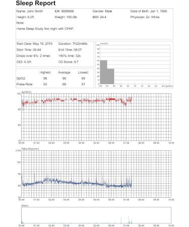 LOOKEE Ring-Pro Wearable Oxygen Monitor - Continuous SpO2 Tracker with Vibration Reminder & Free App Reports | International Shipping Available - Buy Online on GoSupps.com