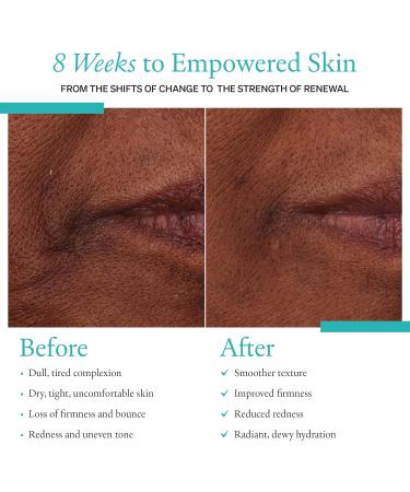 Phosis Calm Deep Hydration Restorative Cream Exceptionally Clean Moisturizer for Sensitive Skin Barrier Repair Face Cream for Women to Support Replenished Radiant Balanced Skin 50ml - Buy Online on GoSupps.com