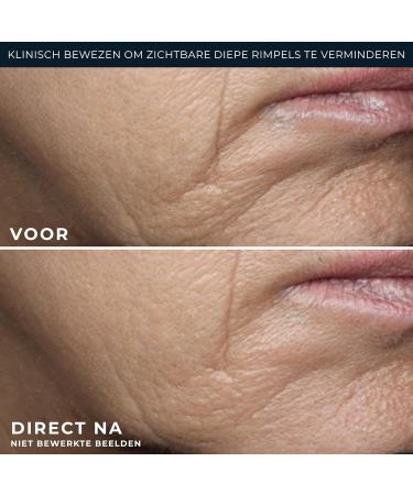 RoC Deep Wrinkle Rich Cream 50ml - Buy Online on GoSupps.com