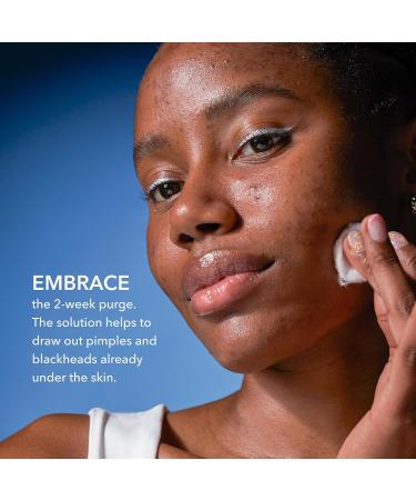 Dr Dennis Gross Alpha Beta 2% BHA+ Breakout Solution - Minimize Pores & Prevent Breakouts - 5 Fl Oz | International Shipping Available - Buy Online on GoSupps.com