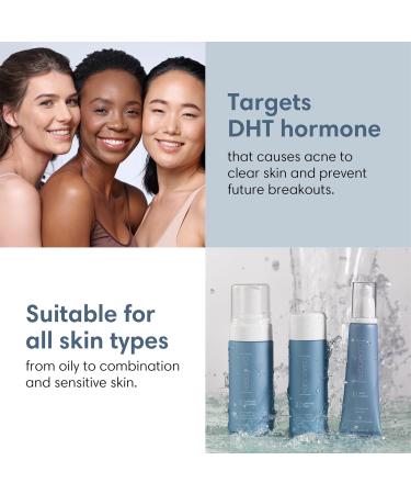 Sensitive Skin Sulfur Acne Lotion - Effective Acne Treatment & Ointment | 1.8 FL Oz - Buy Online on GoSupps.com