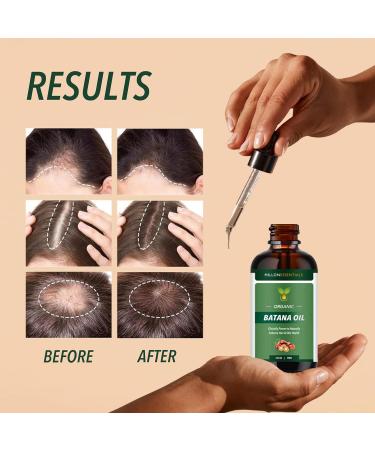 4 oz Pure Organic Batana Oil for Hair Growth & Skin Wellness | Nourishing Treatment from Honduras | Natural Shine & Moisturizing for Men & Women - Buy Online on GoSupps.com