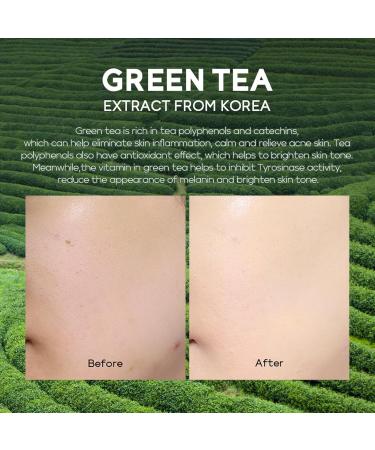 Skincare Set For Teenagers Girls Face Care Sets Skincare Gift Set 4PC Pamper Gifts For Women Includes Cleanser-Eye Cream-Serum-Face Cream Suitable For All Skin Types (One Size Green Tea) Green Tea One Size - Buy Online on GoSupps.com