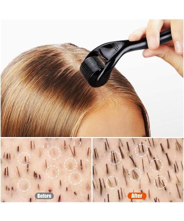 Derma Roller Hair Growth Kit with 5% Minoxidil Serum, Biotin & 0.25mm Roller - Hair Loss Treatment for Men & Women - Buy Online on GoSupps.com