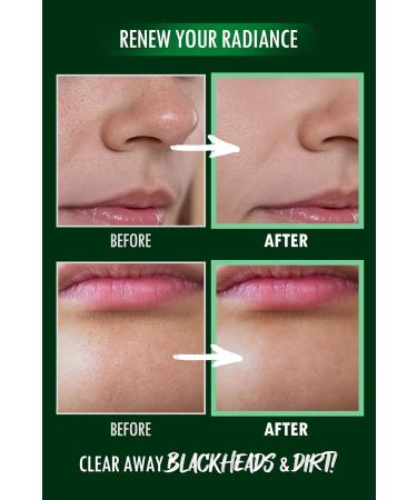 Neogen Dermalogy Pore Zero Peeling Mousse - All-in-One Foaming Exfoliant for Firming & Tightening Skin | K-Beauty 3.38 fl oz - Buy Internationally - Buy Online on GoSupps.com