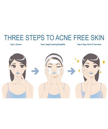 Effective Acne Treatment for Sensitive Skin | 80% Improvement in 4 Weeks | Pimple Cream & Face Toner for Acne Prone Skin - Buy Online on GoSupps.com