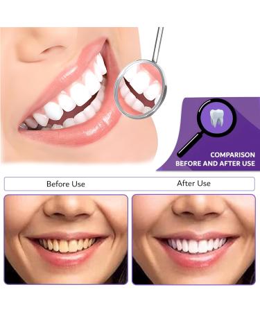 30ml Purple Toothpaste - Advanced Whitening Stain Removal & Color Corrector for a Healthy Smile - Buy Online on GoSupps.com