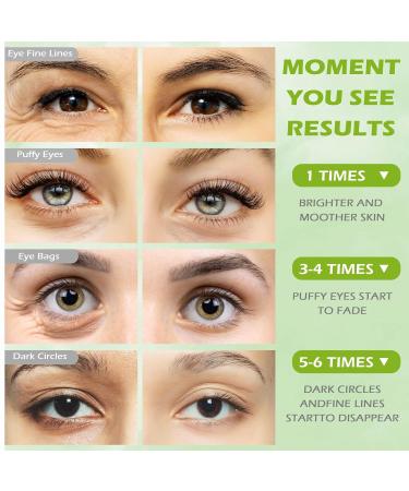 60 PCs Soft Eye Pads with Hyaluronic Acid - Remove Dark Circles Wrinkles & Puffiness | Anti-Aging Eye Masks for Bright Eyes - Buy Online on GoSupps.com