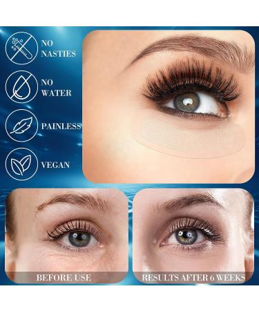 Lounsweer 8 Pairs Micro Needling Eye Patch - Firming Gel Mask for Puffy Eyes & Dark Circles - Buy Online on GoSupps.com