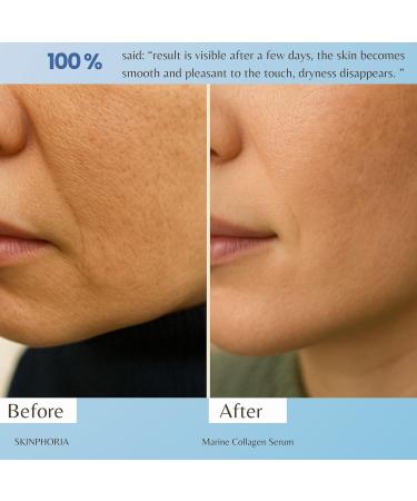 SkinPhoria Niacinamide Brightening Serum 8% Niacinamide Formula for Pore Minimizing, Oil Control & Radiant Skin pH 5.5 30ml Glass Dropper Bottle - Buy Online on GoSupps.com