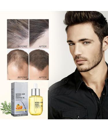 Hair Growth Essence Oil Natural Hair Density Essential Oil Ginger Hair Regrowth Essence Nourishes Repair Dry Damaged Hair - Buy Online on GoSupps.com