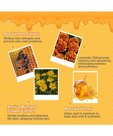 Manuka Eczema Eczema Cream Hand Foot Psoriasis Cream for Atopic Eczema Heat Rash Hidradenitis Itching Eczema Psoriasis Leg Armpit Foot Hand Irritated Skin for All Ages 4 Fl Oz (Pack of 1) - Buy Online on GoSupps.com