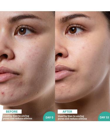 Selfless by Hyram Salicylic Acid & Sea Kelp Serum - Clear Pores & Control Oil | 1 fl oz - Buy Online on GoSupps.com