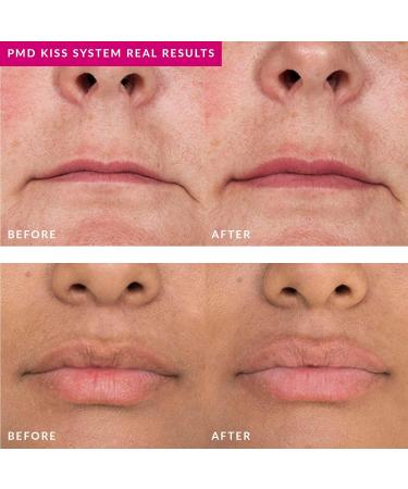 PMD Smart Lip Plumping Serum 10 ml - Buy Online on GoSupps.com