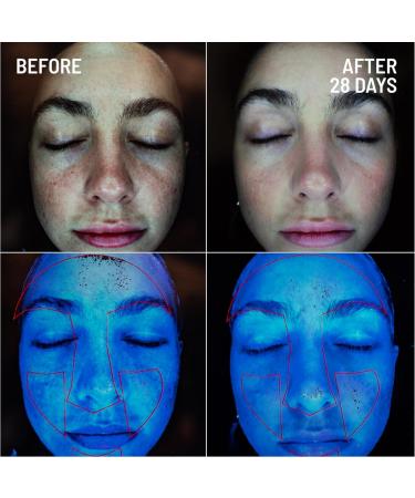 Dr. Brandt Skincare Microdermabrasion Renewing Age-Defying Face Exfoliator 2 oz - Best for Younger-Looking Skin - Buy Online on GoSupps.com