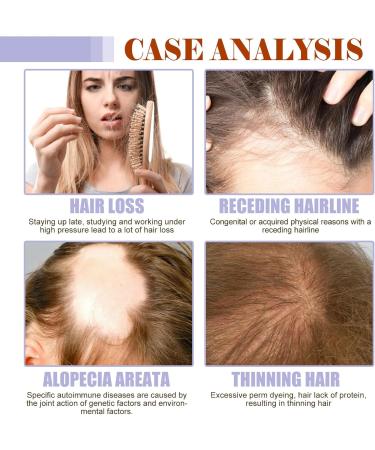 Hair Growth Oil - Hair Supplements For Women with Vitamin B6 Pumpkin Seed Oil For Skincare - Boost Hair Growth For Eyelashes Eyebrows & Dry Damaged Hair Moisturizer Face Hair - Buy Online on GoSupps.com