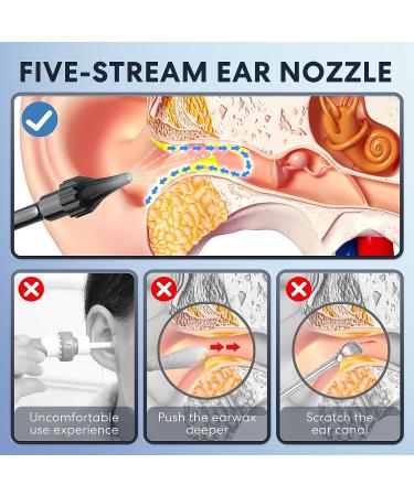 Electric Ear Wax Removal Kit - 4 Pressure Modes for Safe & Effective Ear Cleaning - Includes Basin and 10 Tips - Black - Buy Online on GoSupps.com