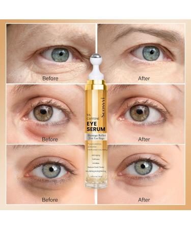Caffeine Eye Serum for Dark Circles & Puffiness | Anti-Aging Eye Care with Ice Roller | Unisex Under Eye Treatment - Buy Online on GoSupps.com