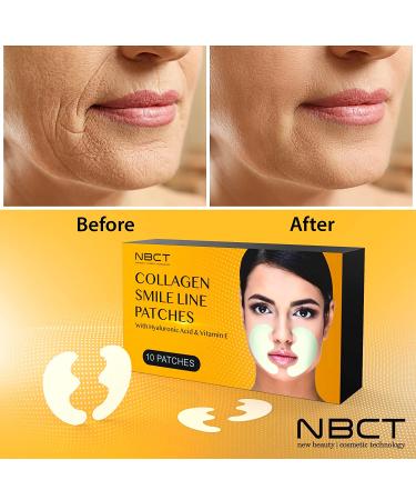 Smile Line Patches - Anti-Wrinkle Facial Strips - 5 Pairs - Moisturizing & Tightening - Laugh Lines Care - Face Tape for Wrinkles - 2022 Formula - Buy Online on GoSupps.com