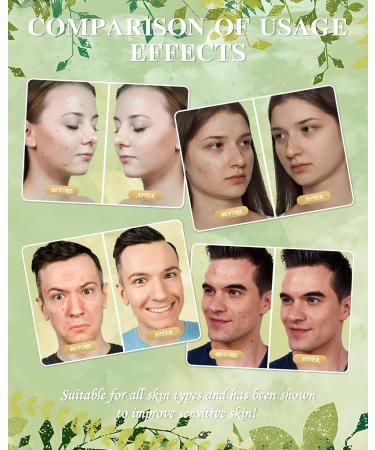 PAUOPOH Beef Tallow for Skin - Whipped Tallow Balm with Manuka Honey Handmade Moisturizer for Sensitive Skin (Lavender) - Buy Online on GoSupps.com