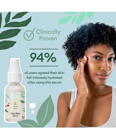 LUMA & LEAF Clear Slate Niacinamide Serum for Face Redness & Acne Relief with Bakuchiol & Aloe Vera Hydrating Vegan Daily Face Serum for Oily & Combination Skin - Buy Online on GoSupps.com