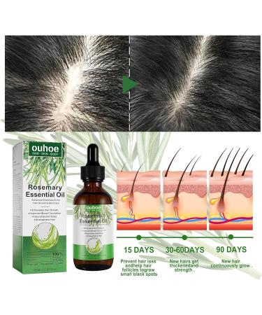 Firulab 60ml Rosemary Oil for Hair Growth and Hair Loss Refreshing Rosemary Oil for Hair Growth and Damaged Hair - Buy Online on GoSupps.com