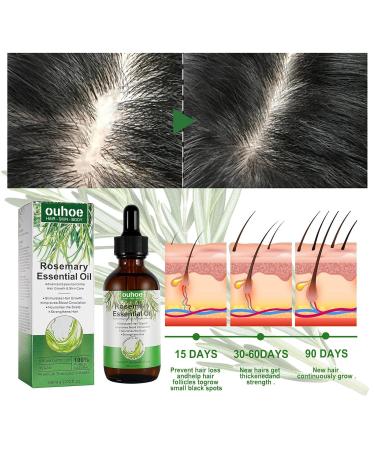 Rosemary Oil for Hair Growth - Nourishing Essential Oil | Strengthen Scalp & Hair | Aromatherapy | 2 fl. oz | Ideal for Skin & Face - Buy Online on GoSupps.com