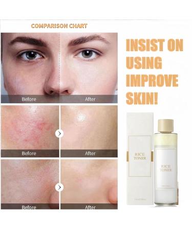 Rice Toner Rice Toner Korean Moisturizing Rice Water Toner Rice Water Bright Essence Toner Toner Skincare Hydrating Toner Rice Water Skin Toner Toner for Oily Skin Face Toner for Oily Skin Toner - Buy Online on GoSupps.com