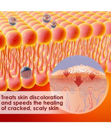 Anti Itching Cream Extra Strong Intensive Moisturizing Cream Natural Body Lotion 20g Soothes Nourishes Redness Itchy Skin for Adults and Children - Buy Online on GoSupps.com