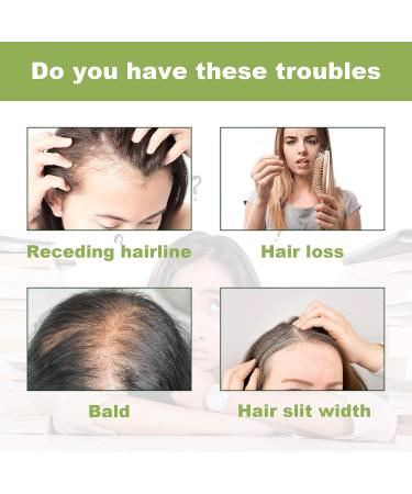 Buy Glammagus Rosemary Hair Oil with Biotin for Hair Growth - 2.02 fl oz (60ml) | Pure & Natural Hair Care for Men & Women - International Shipping Available - Buy Online on GoSupps.com