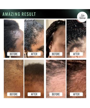 Edge Naturale Follicle Enhancer - Natural Edges Growth Treatment for All Hair Types - Repair & Regrow Hair Edges - Made in the USA - 4 Ounce - Buy Online on GoSupps.com